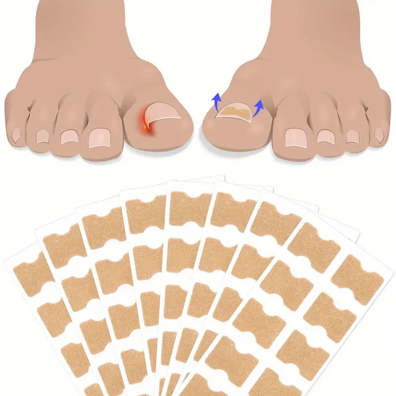 Nageltrång korrigeringstejp (60 st)