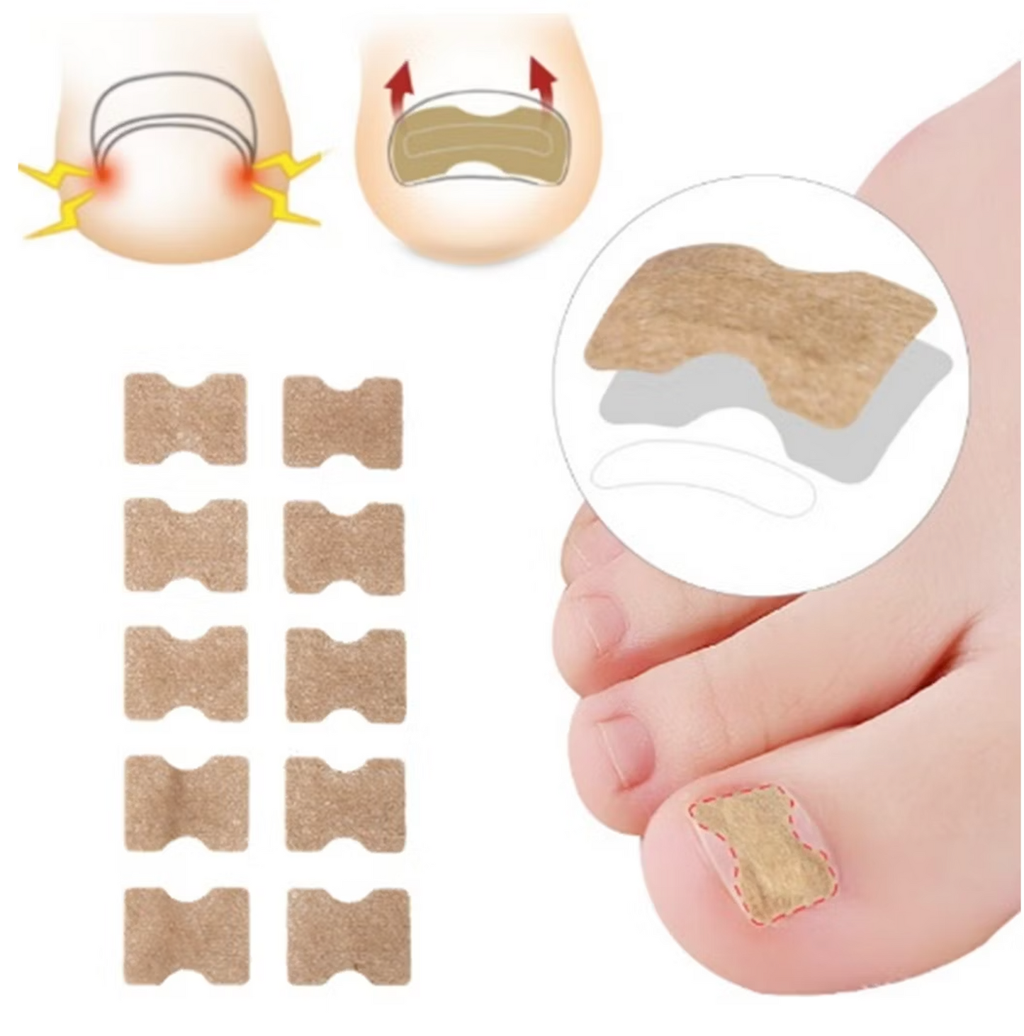Nageltrång korrigeringstejp (60 st)