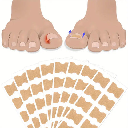 Nageltrång korrigeringstejp (60 st)
